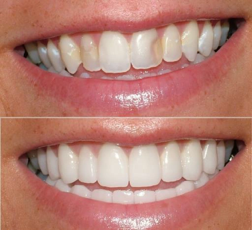Worthington Advanced Dentistry