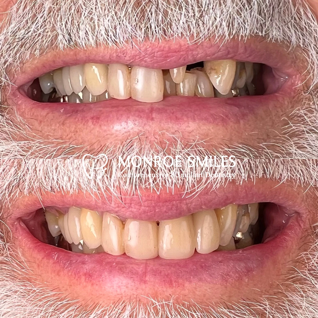 Monroe Smiles