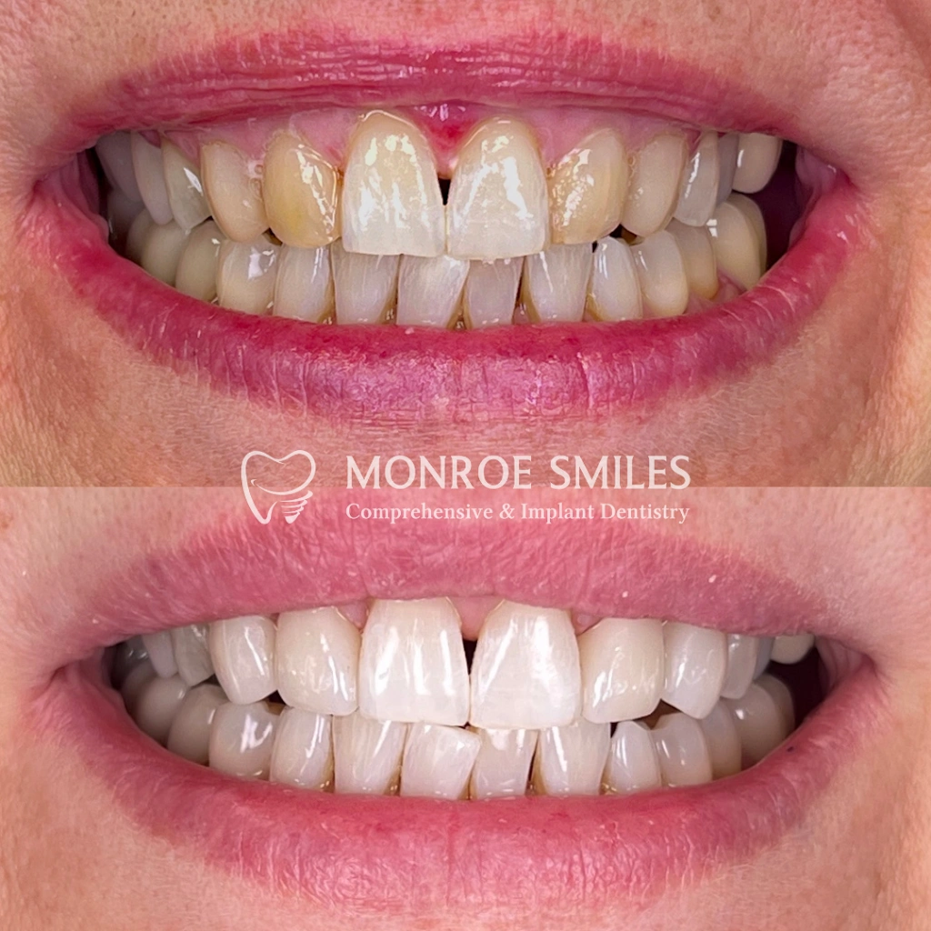Monroe Smiles