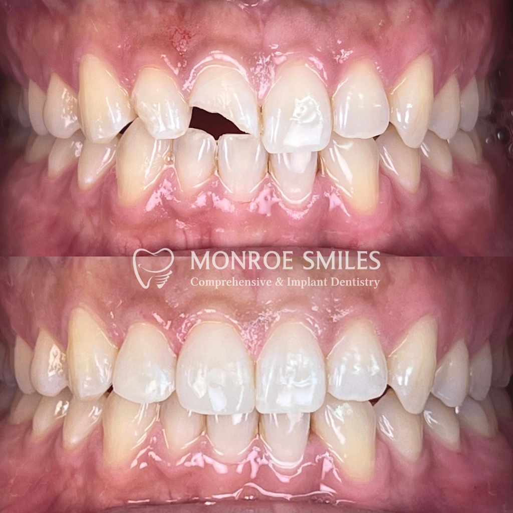 Monroe Smiles