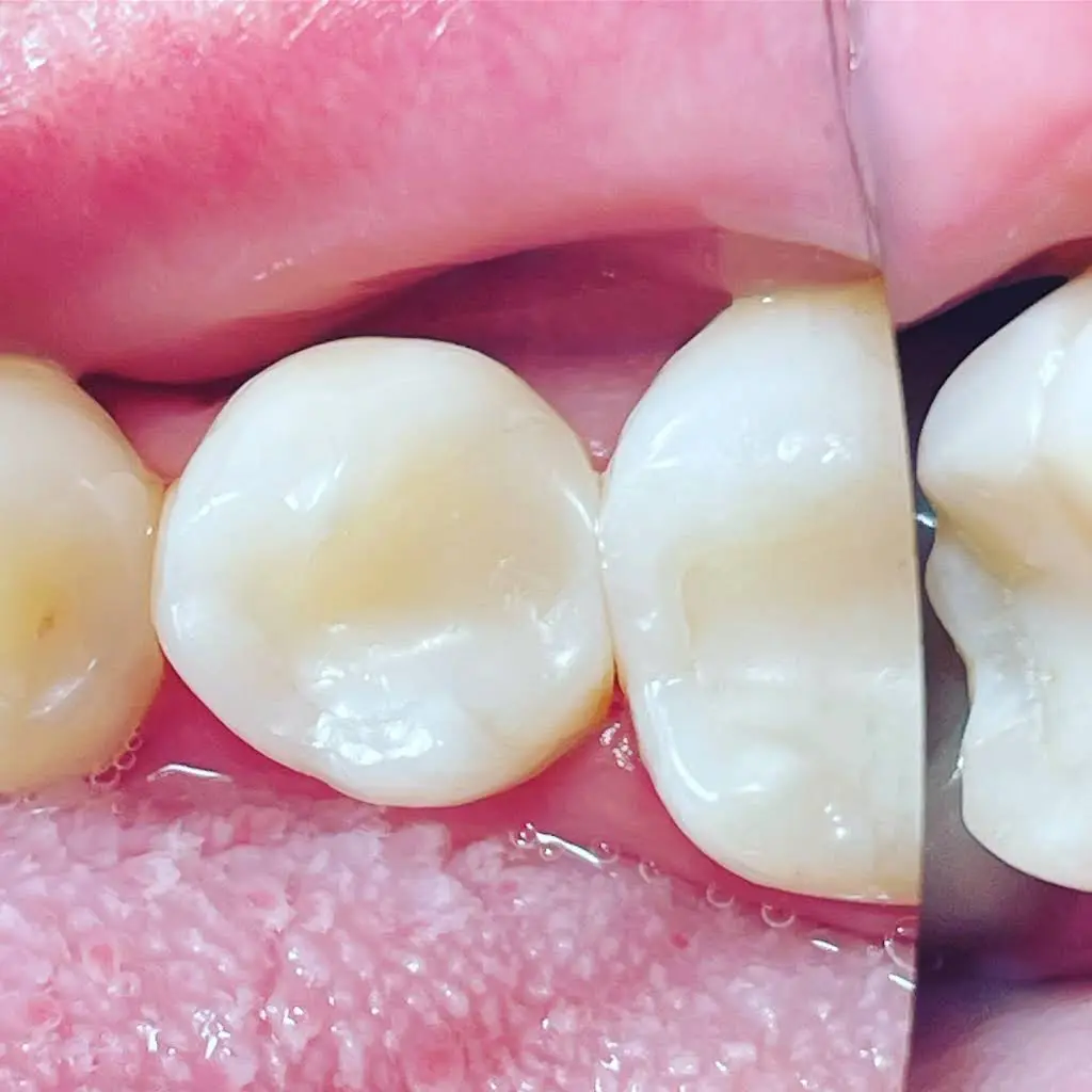 PreserveYourTeeth - Dentistry Alice Urbankova DDS, PhD