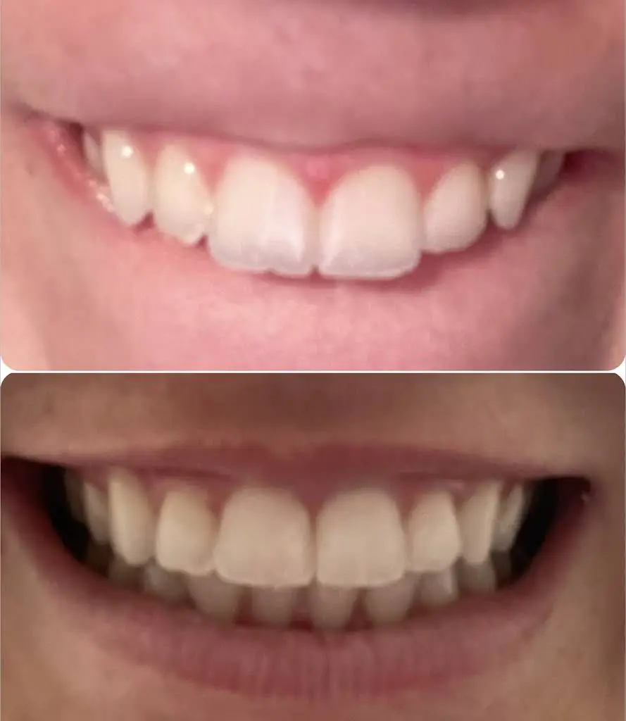 Straight Set Orthodontics