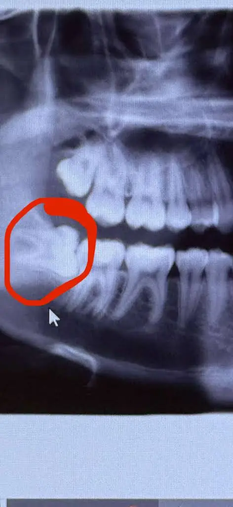 Dental Oral Surgery