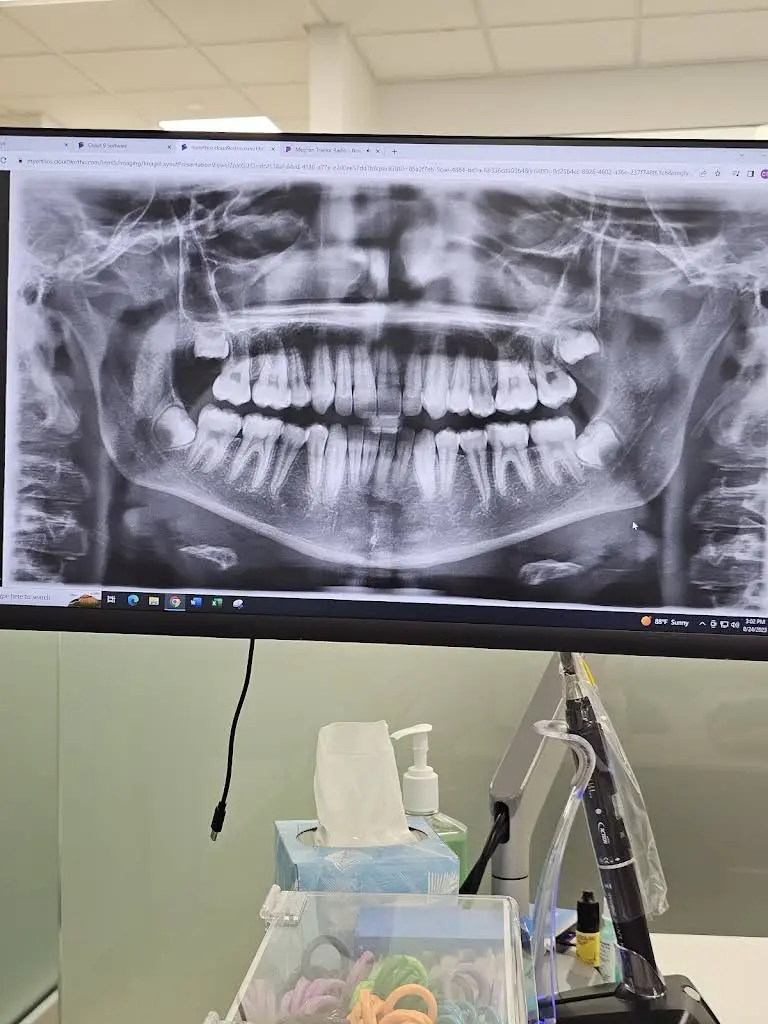 CT Braces