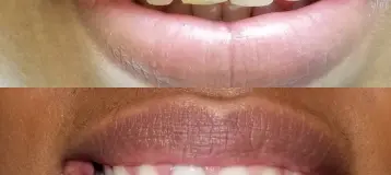 Connecticut Dental Group- M. Azar DDS