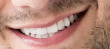 Mondovi Dental