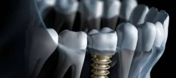 Advanced Valley Dental