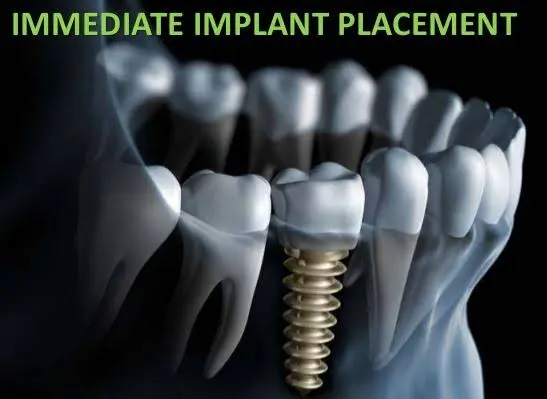 Advanced Valley Dental - Professional dental clinic exterior with modern facilities