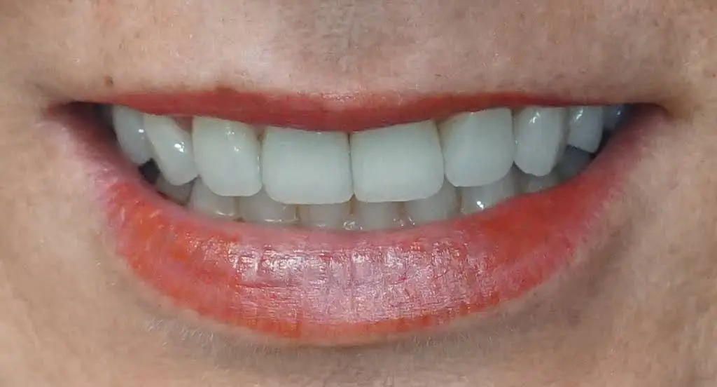 Advanced Valley Dental