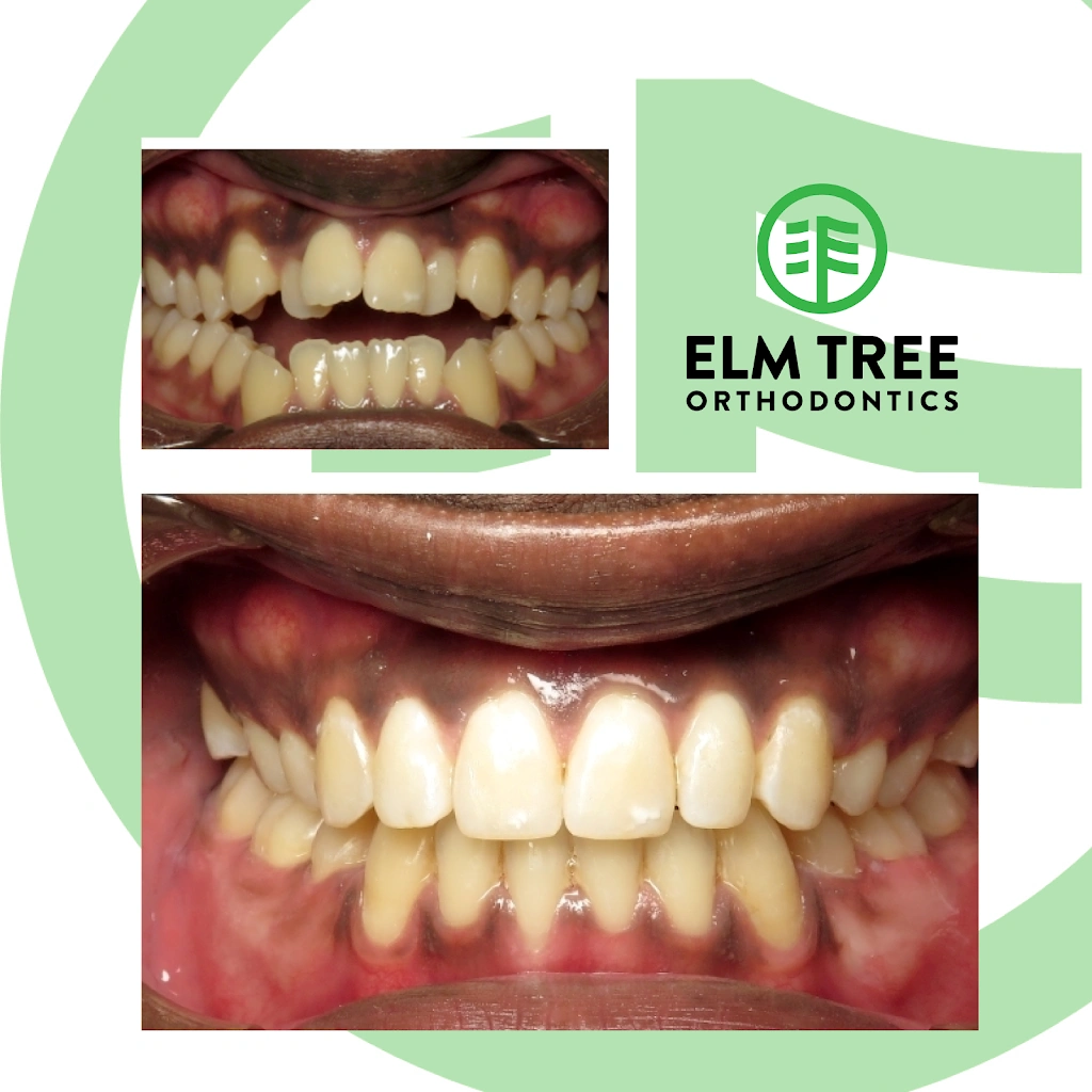 Elm Tree Orthodontics