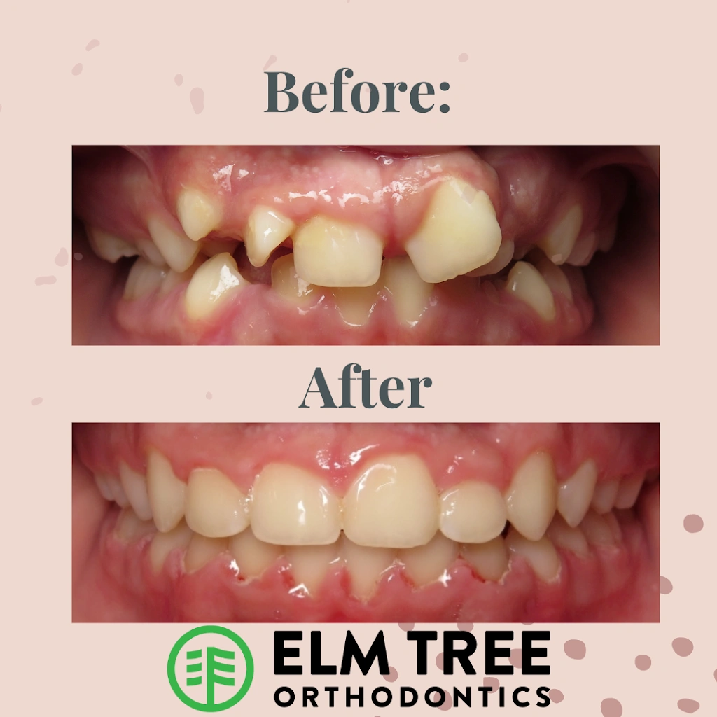 Elm Tree Orthodontics