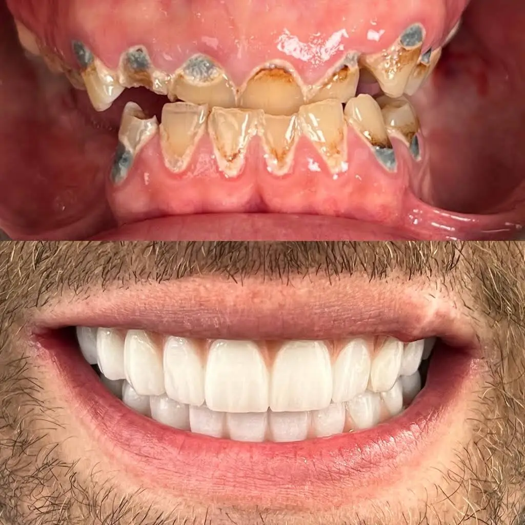 Signature Smiles Dental Implants and Cosmetic Dentistry