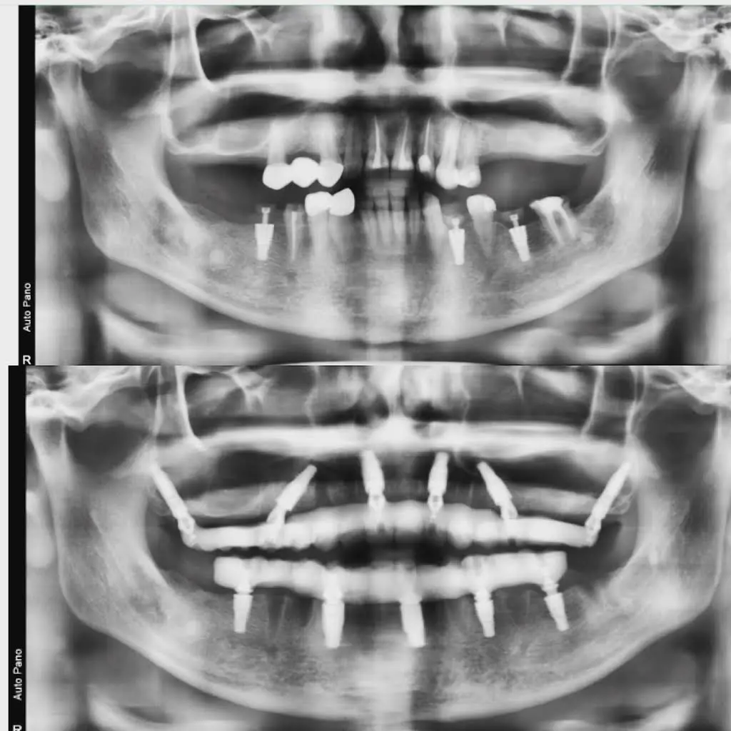 Signature Smiles Dental Implants and Cosmetic Dentistry
