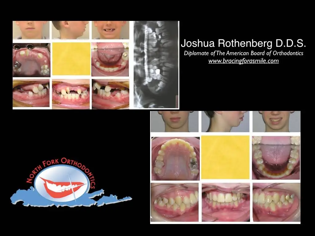 Joshua Rothenberg D.D.S., P.C. / North Fork Orthodontics