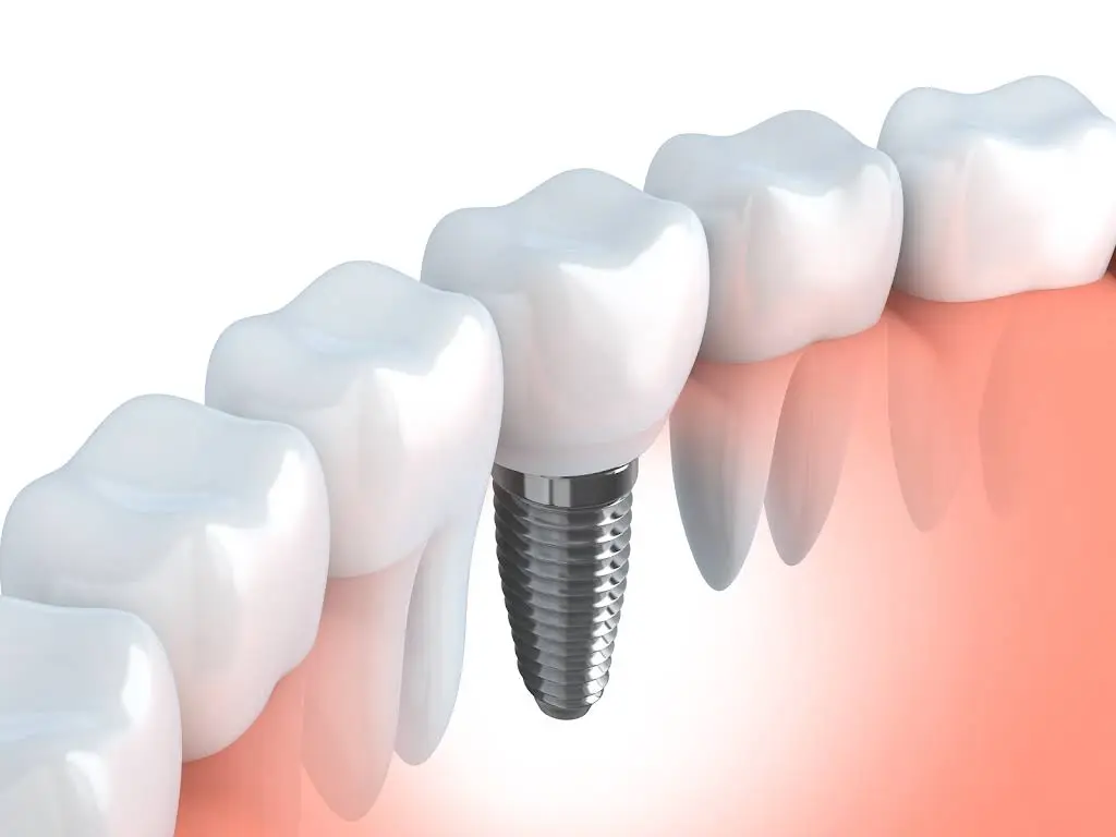Long Island Emergency Dental Pros