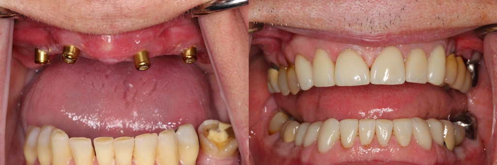Cosmetic and Implant Dentistry of Connecticut