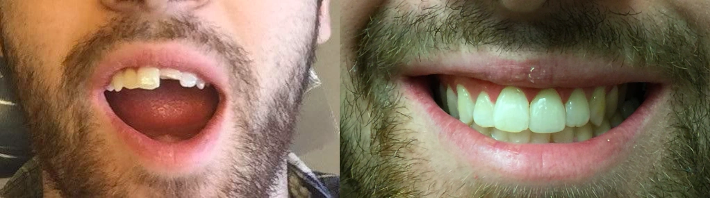 Cosmetic and Implant Dentistry of Connecticut