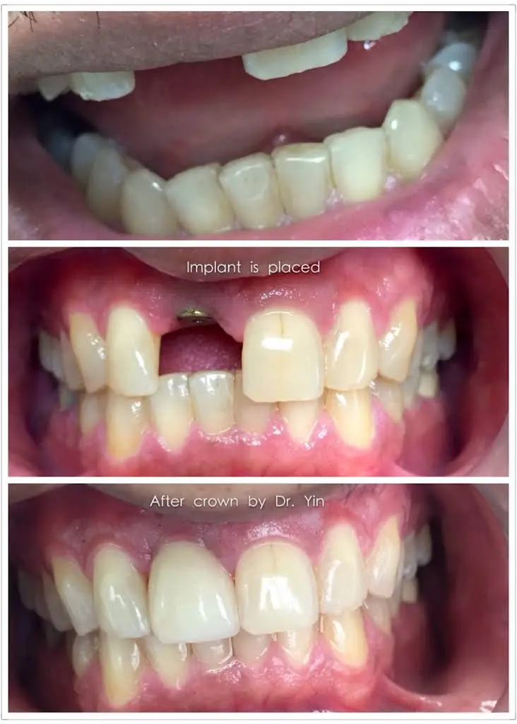 West Hartford Dental PC