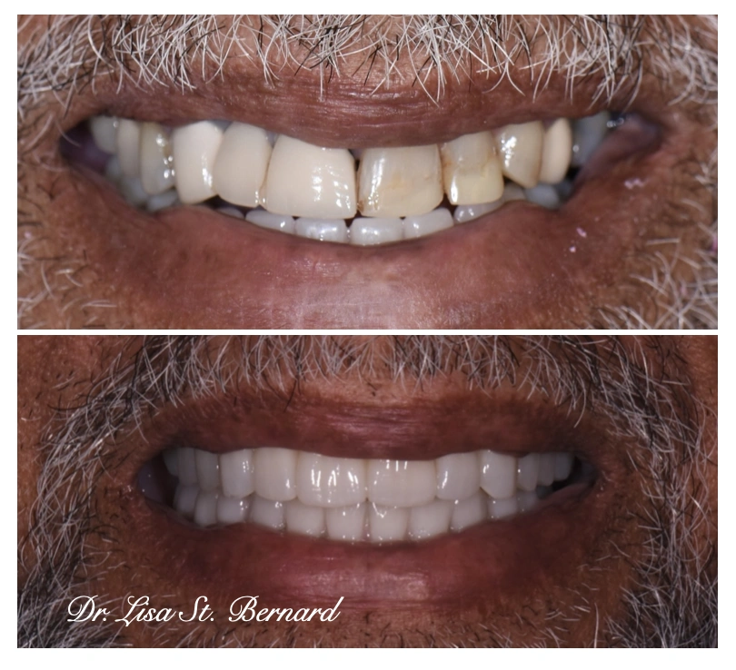 Windsor Prosthodontic Dentistry