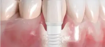 Pleasant Valley Holistic and Implant Dentistry