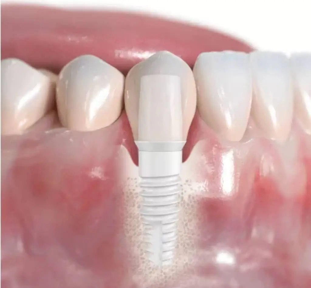 Pleasant Valley Holistic and Implant Dentistry - Professional dental clinic exterior with modern facilities