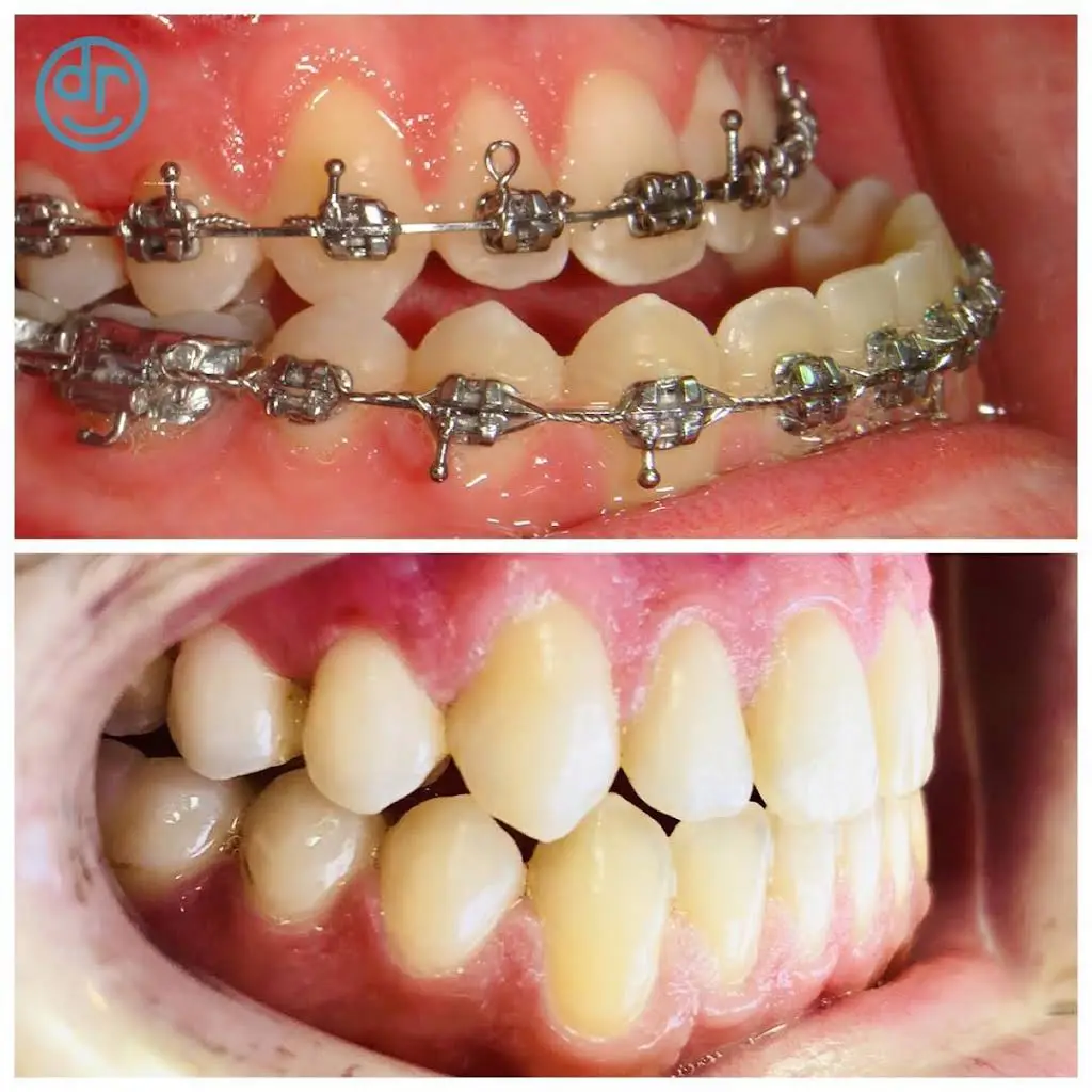 Dobie Revolution Orthodontics