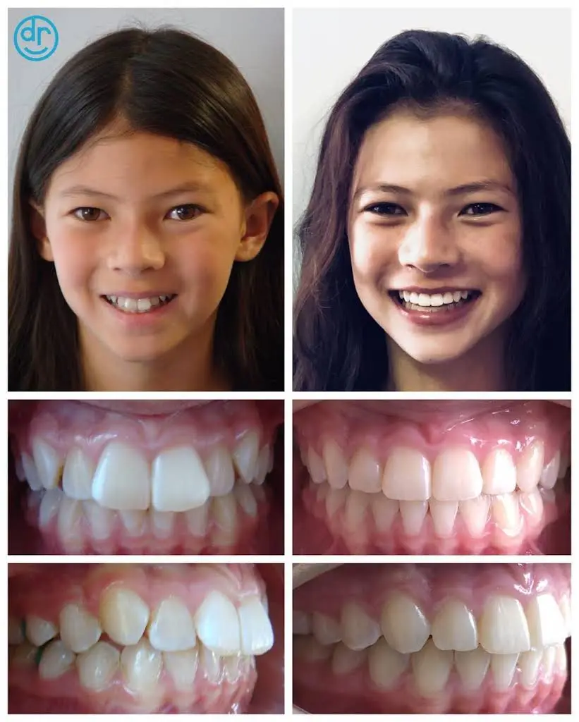 Dobie Revolution Orthodontics