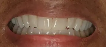 16 Acres Dental