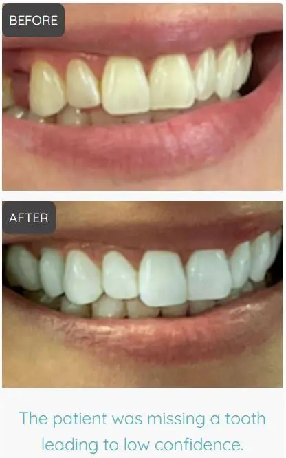 Affinity Dental of South Windsor