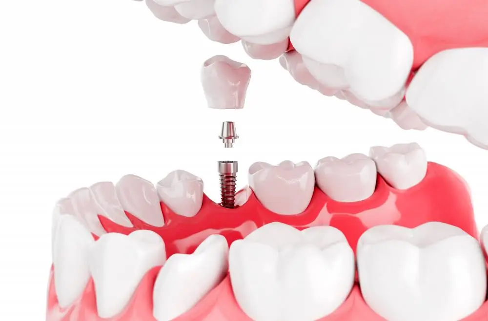 Dental Team of South Windsor