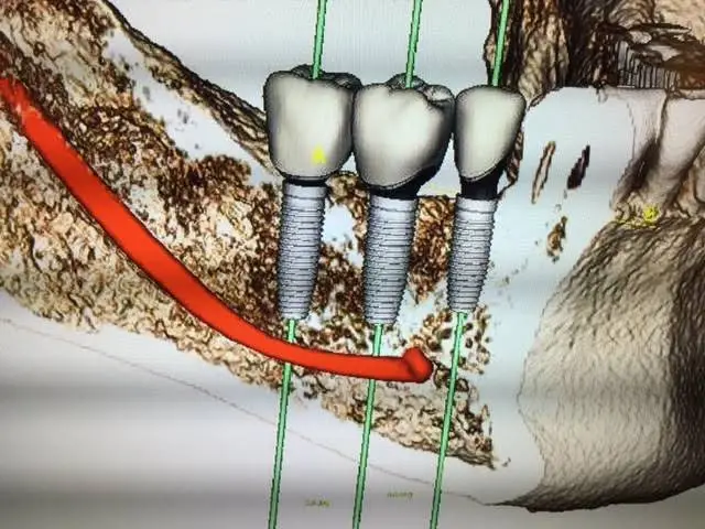 Madison Dental Spa