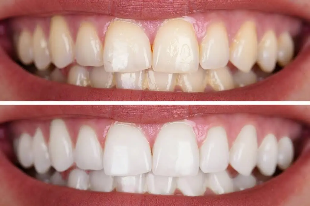 Cavalieri Dental