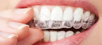 Smiles Dental