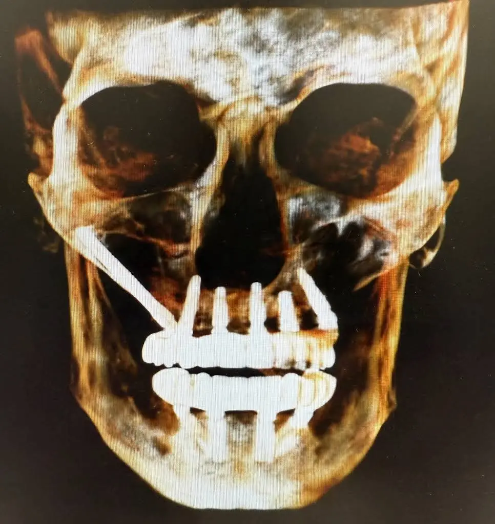 Signature Smiles Family & Implant Dentistry
