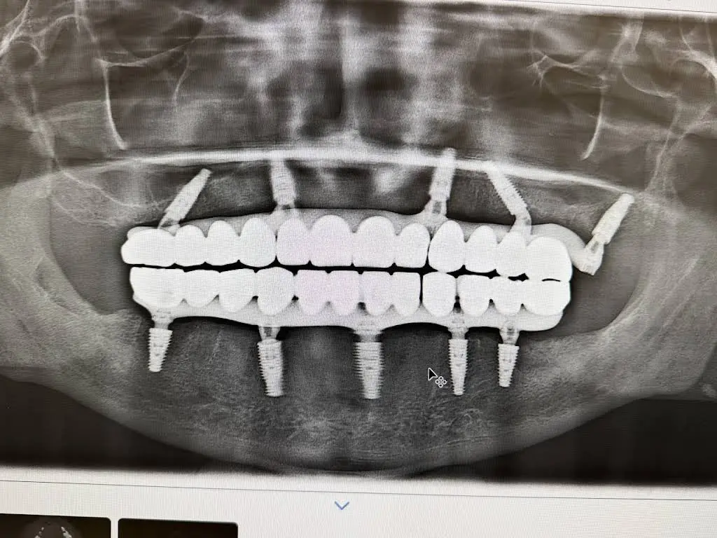 Signature Smiles Family & Implant Dentistry