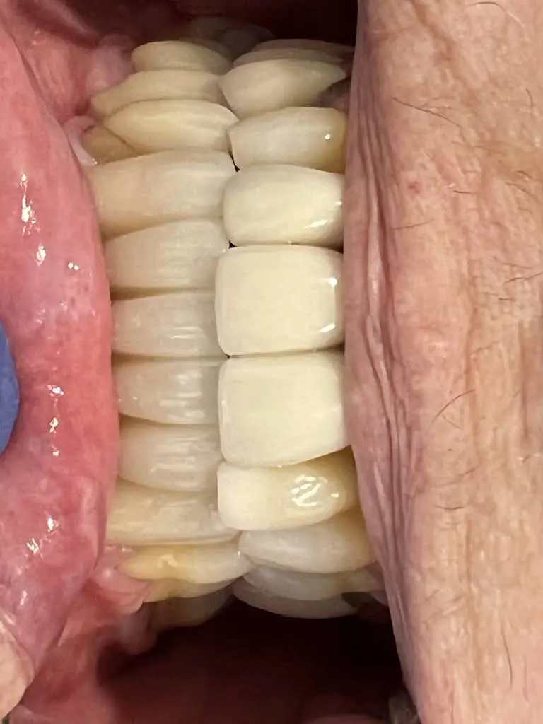 Purple Dental LLC