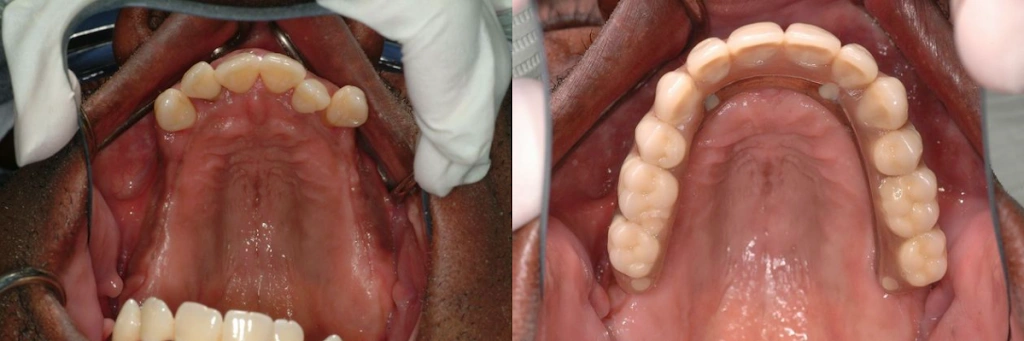 Advanced Cosmetic and Implant Dentistry