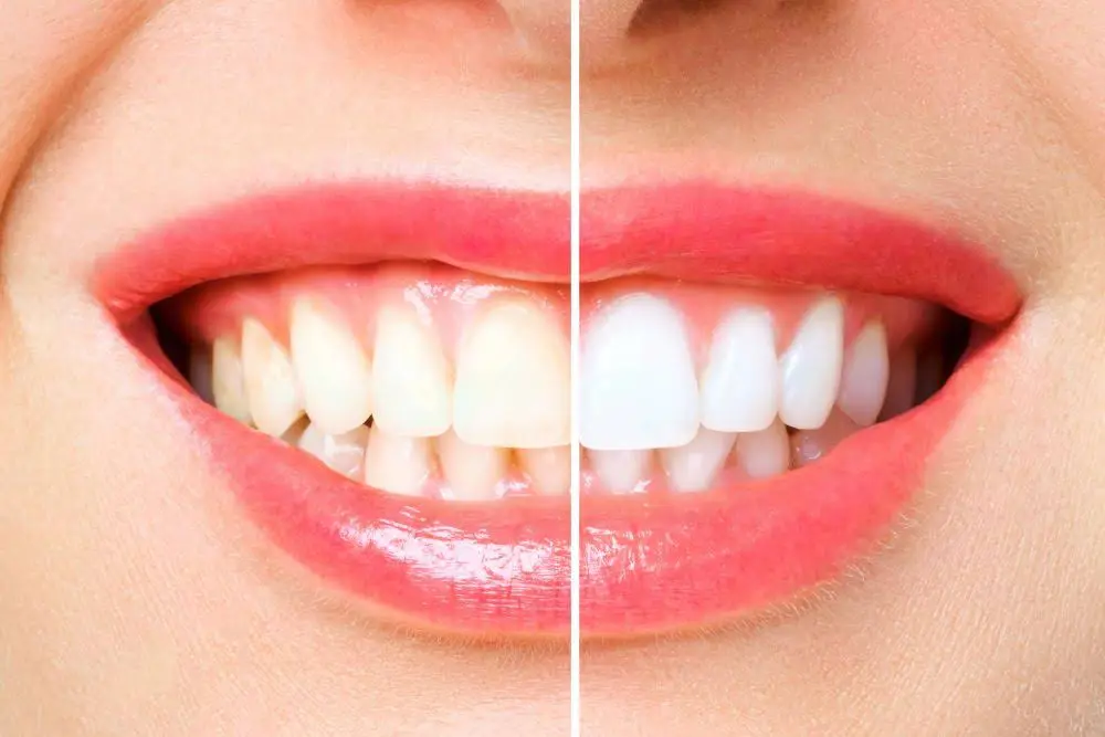 Gatehouse Dental