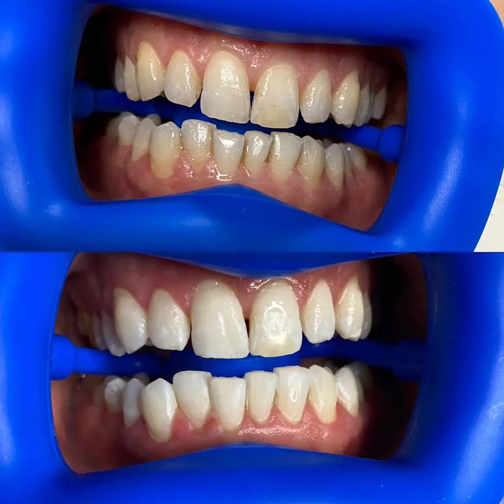 Luxe Teeth Whitening CT - Professional dental clinic exterior with modern facilities