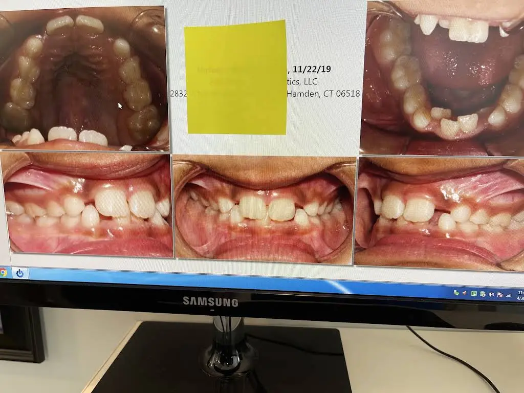 Advanced Orthodontics LLC