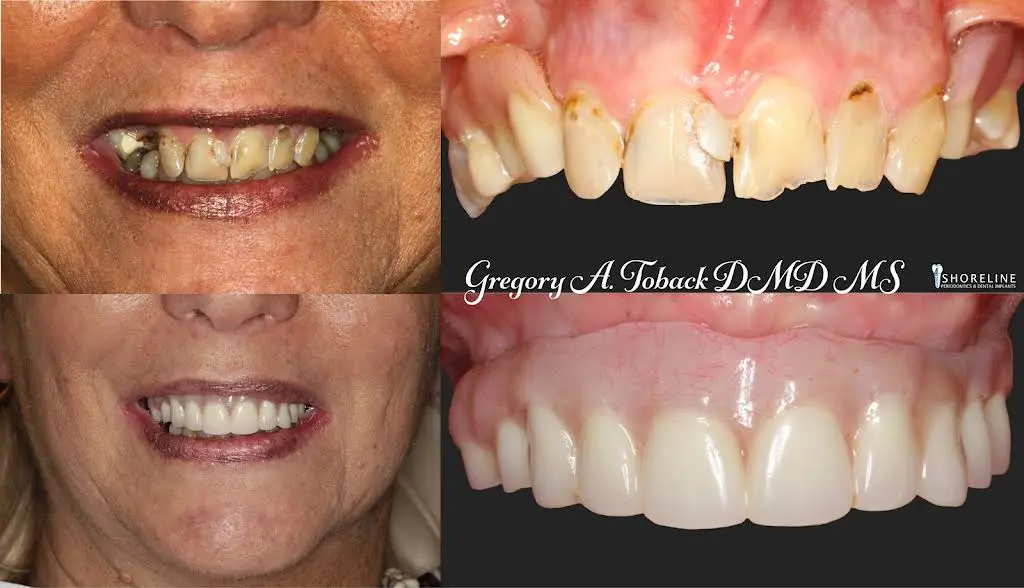 Shoreline Periodontics