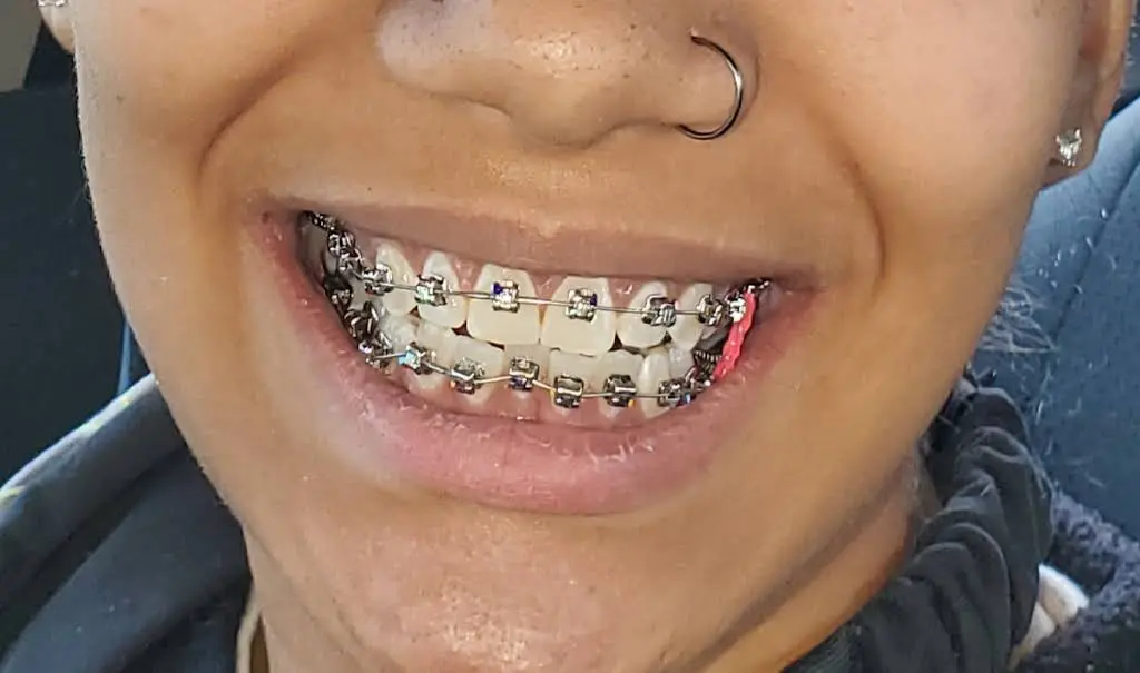 Kozlowski DePascale Orthodontics