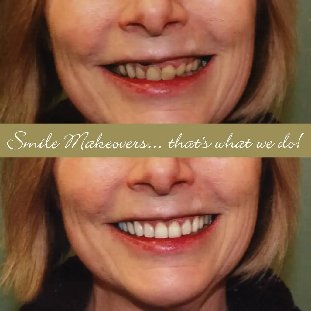 Valley Dentists of Belchertown