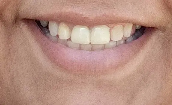 Dental Dreams