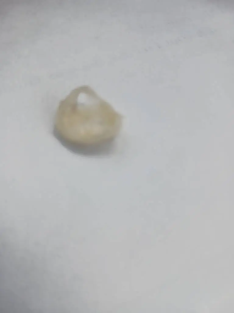 Dental Dreams
