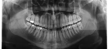 Central New England Oral and Maxillofacial Surgery
