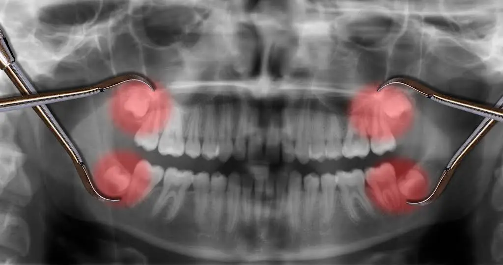 Central New England Oral and Maxillofacial Surgery