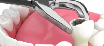 Thompson Smiles