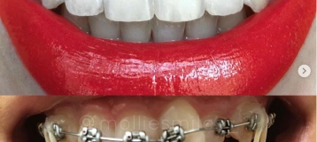 Treehouse Orthodontics