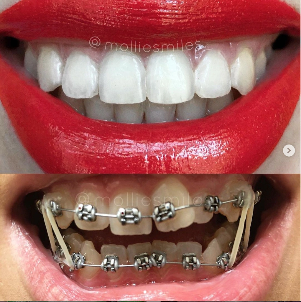 Treehouse Orthodontics - Professional dental clinic exterior with modern facilities